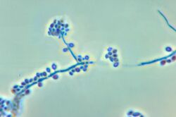 Conidiophores and conidia of the fungus Sporothrix schenckii PHIL