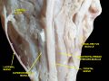 Medial rectus muscle