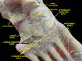 Tarsometatarsal joints