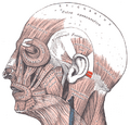 Otoplasty