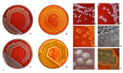 Pseudomonas aeruginosa on blood agar