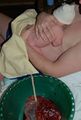 Umbilical non-severance one hour postpartum
