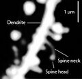Dendritic spines