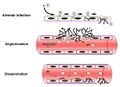 Invasive Disease Mechanism Diagram