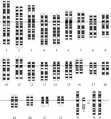 Human Karyotype