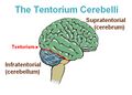 Cerebellar tentorium illustration