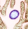 Nipah virus from an infected VERO cell