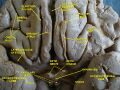 Longitudinal fissure