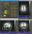 Screenshot of AFNI software