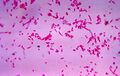 Fusobacterium novum