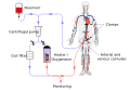 Diagram of normothermic regional perfusion of abdominal organs prior in preparation for transplantation