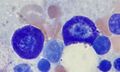Mast cells in bone marrow