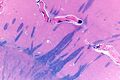 Globus pallidus and putamen - very low magnification