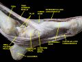 Tibialis posterior muscle