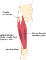 Vastus lateralis muscle anatomy