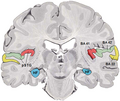 Human temporal lobe areas