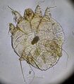 Sarcoptes scabiei