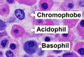 Histology of pars distalis of the anterior pituitary with chromophobes, basophils, and acidophils, annotated