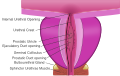 Prostatic utricle