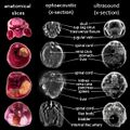 Multispectral optoacoustic tomography
