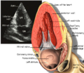 Transthoracic echocardiogram
