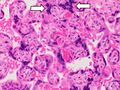 Syncytiotrophoblast