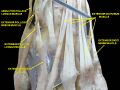 Extensor indicis muscle.