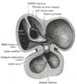 Primitive ventricle