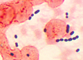 Histological image of Enterococcus in pneumonia