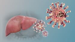 Hepatitis C