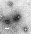 Polio eradication