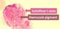 Microphotograph of Plasmodium ovale microgametocyte in Giemsa-stained thin blood film, with Schüffner's dots and hemozoin pigment