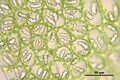 Lipid droplet
