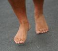 Pronation of the foot