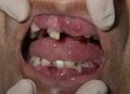 AML Case 66