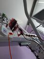 Packed red blood cells