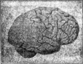 1907 image of a brain (Labour and Childhood)