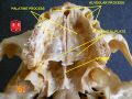 Vomer bone