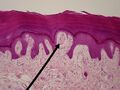 Photomicrograph of Meissner's corpuscle