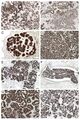 Jaagsiekte sheep retrovirus