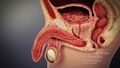 3D Medical Animation of male accessory gland