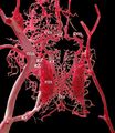 Circulus arteriosus of a sheep
