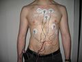 Holter monitor used for cardiac monitoring