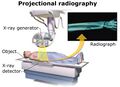 Projectional_radiography