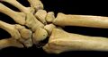 Right Human Posterior Distal Radius Ulna Carpals