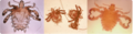 Crab Lice CDC