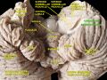 Central lobule