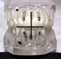Teeth model front view with FDI Notation