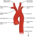 Thoracic aorta
