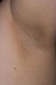 Epidermis